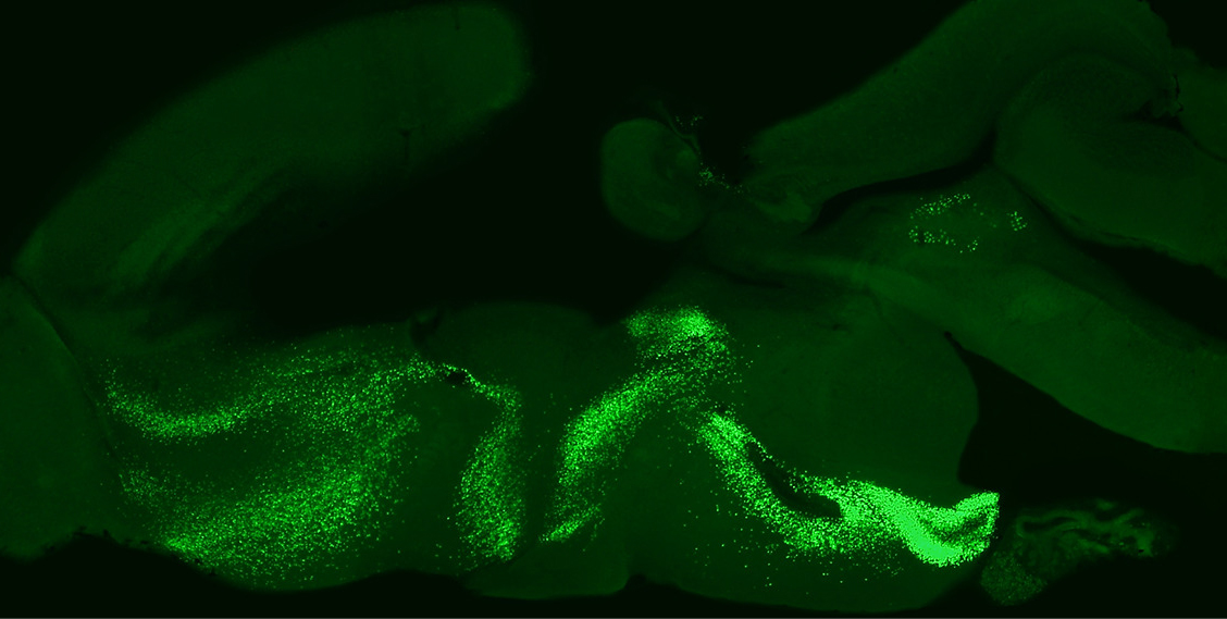 Distribution of the transcription factor islet-1 in the central nervous system of nonteleost actinopterygian fish: Relationship with cholinergic and catecholaminergic systems